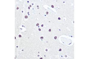 Immunohistochemistry of paraffin-embedded human brain using 53BP1 Rabbit pAb (ABIN6128833, ABIN6149414, ABIN6149415 and ABIN6221431) at dilution of 1:100 (40x lens). (TP53BP1 antibody  (AA 1763-1977))