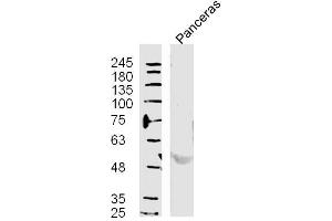 Mouse Pancreas lysates probed with Polyclonal Antibody, unconjugated  at 1:300 overnight at 4°C followed by a conjugated secondary antibody at 1:10000 for 60 minutes at 37°C. (MAPK7 antibody  (pThr219, pTyr221))