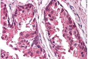 Human Prostate (formalin-fixed, paraffin-embedded) stained with TICAM1 antibody ABIN213993 at 5 ug/ml followed by biotinylated goat anti-rabbit IgG secondary antibody ABIN481713, alkaline phosphatase-streptavidin and chromogen. (TICAM1 antibody  (C-Term))