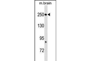Western Blotting (WB) image for anti-Fatty Acid Synthase (FASN) (AA 942-973) antibody (ABIN1537694)