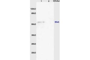 L1 mouse heart lysates L2 mouse pancreas lysates probed with Anti FLIP/c FLIP Polyclonal Antibody, Unconjugated (ABIN725255) at 1:200 overnight at 4 °C. (FLIP antibody  (AA 7-100))