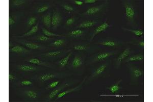Immunofluorescence of purified MaxPab antibody to NR0B1 on HeLa cell. (NR0B1 antibody  (AA 1-470))