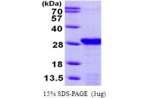 SDS-PAGE (SDS) image for PDGFA Associated Protein 1 (PDAP1) (AA 1-181) protein (His tag) (ABIN667807)