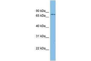 WB Suggested Anti-ADRBK1 Antibody Titration: 0. (GRK2 antibody  (N-Term))