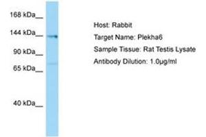Image no. 1 for anti-Pleckstrin Homology Domain Containing, Family A Member 6 (PLEKHA6) (AA 176-225) antibody (ABIN6749876) (PLEKHA6 antibody  (AA 176-225))