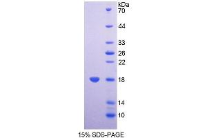 SDS-PAGE (SDS) image for Succinate Dehydrogenase Complex, Subunit D, Integral Membrane Protein (SDHD) (AA 1-159) protein (His tag) (ABIN6237617) (SDHD Protein (AA 1-159) (His tag))