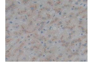 Detection of SELL in Human Liver Tissue using Polyclonal Antibody to Selectin, Leukocyte (SELL) (L-Selectin antibody  (AA 109-346))