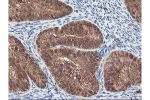 Image no. 9 for anti-Leucine Carboxyl Methyltransferase 1 (LCMT1) antibody (ABIN1499109)