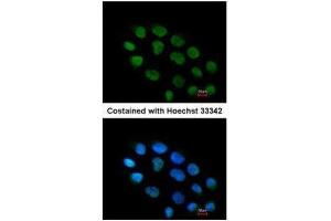 ICC/IF Image Immunofluorescence analysis of paraformaldehyde-fixed A431, using ZNF7, antibody at 1:200 dilution. (ZNF7 antibody)