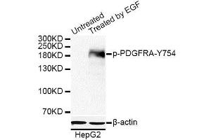 Western blot analysis of extracts of HepG2 cells, using Phospho-PDGFRA-Y754 antibody. (PDGFRA antibody  (pTyr754))
