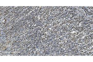 IHC analysis of Transketolase/TKT using anti-Transketolase/TKT antibody (ABIN7598958). (TKT antibody  (AA 1-116))