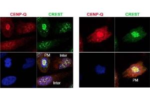 Image no. 1 for anti-Centromere Protein Q (CENPQ) antibody (ABIN401060) (CENPQ antibody)