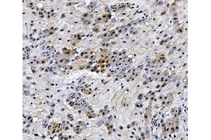 IHC analysis of HMGB3 using anti-HMGB3 antibody (ABIN7603126). (HMGB3 antibody  (N-Term))