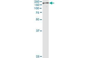Immunoprecipitation of NUMA1 transfected lysate using anti-NUMA1 monoclonal antibody and Protein A Magnetic Bead , and immunoblotted with NUMA1 MaxPab rabbit polyclonal antibody. (NUMA1 antibody  (AA 200-306))