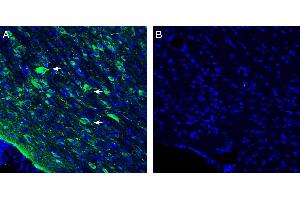 Expression of Vasopressin V1A Receptor in rat horizontal diagonal band. (AVPR1A antibody  (Intracellular))