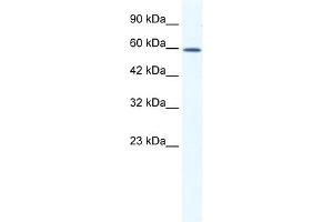 DDX5 antibody used at 1.