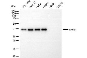 Western blotting analysis using SMN1 antibody (ABIN7800470). (Recombinant SMN1 antibody)