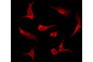 ABIN6275511 staining HeLa by IF/ICC. (EWSR1 antibody  (Internal Region))