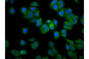 Immunofluorescence staining of HepG2 cells with ABIN7167248 at 1:133, counter-stained with DAPI. (RAB21 antibody  (AA 141-222))