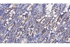 Detection of CNX in Human Small intestine Tissue using Monoclonal Antibody to Calnexin (CNX) (Calnexin antibody  (AA 239-461))