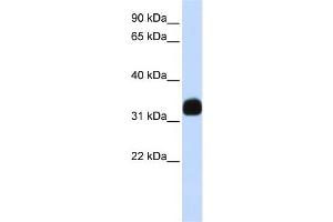 Western Blotting (WB) image for anti-Mediator Complex Subunit 27 (MED27) (Middle Region) antibody (ABIN2778099)