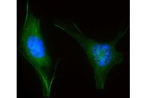 Immunofluorescent analysis of 4 % paraformaldehyde-fixed, 0. (LZIC antibody  (AA 81-109))