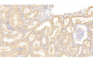 Detection of IL9 in Human Kidney Tissue using Polyclonal Antibody to Interleukin 9 (IL9) (IL-9 antibody  (AA 19-144))