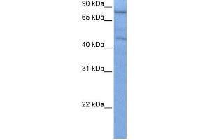 WB Suggested Anti-ZNF555 Antibody Titration:  0. (ZNF555 antibody  (C-Term))