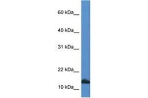 Image no. 1 for anti-Cytidine Deaminase (CDA) (C-Term) antibody (ABIN6746945) (CDA antibody  (C-Term))