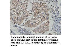 Image no. 1 for anti-Ankyrin Repeat Domain 33 (ANKRD33) antibody (ABIN1574705) (ANKRD33 antibody)