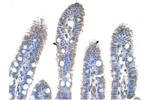 OTC antibody was used for immunohistochemistry at a concentration of 4-8 ug/ml to stain Epithelial cells of intestinal villus (arrows) in Human Intestine. (OTC antibody  (N-Term))