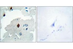 Immunohistochemistry analysis of paraffin-embedded human brain tissue, using PTTG Antibody. (PTTG1 antibody  (AA 116-165))