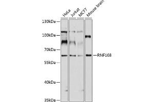 Western blot analysis of extracts of various cell lines, using RNF168 antibody (ABIN1682548, ABIN3017831, ABIN3017832 and ABIN6220281) at 1:1000 dilution. (RNF168 antibody  (AA 300-571))