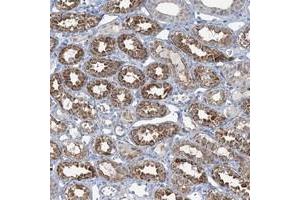 Immunohistochemical staining of human kidney with TMLHE polyclonal antibody  shows strong cytoplasmic positivity in cells in tubules.