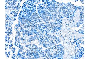Immunohistochemistry (IHC) image for anti-Bromodomain Containing 3 (BRD3) (AA 676-726) antibody (ABIN7455203) (Recombinant BRD3 antibody  (AA 676-726))