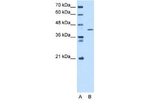 SEPHS1 antibody used at 5 ug/ml to detect target protein. (SEPHS1 antibody  (C-Term))