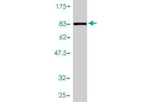 Western Blot detection against Immunogen (79. (DNAJC7 antibody  (AA 1-484))