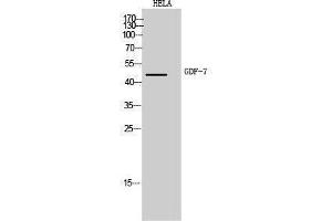 Western Blotting (WB) image for anti-Growth Differentiation Factor 7 (GDF7) (Internal Region) antibody (ABIN3181491) (GDF7 antibody  (Internal Region))