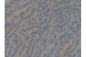Detection of GDF10 in Human Thyroid Tissue using Polyclonal Antibody to Growth Differentiation Factor 10 (GDF10) (GDF10 antibody  (AA 337-477))