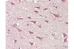 Anti-SLCO6A1 / OATP-I antibody IHC staining of human brain, cortex. (SLCO6A1 antibody  (AA 678-707))