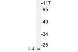 Western blot analysis of IL-4 antibody in extracts from MCF-7cells. (IL-4 antibody)