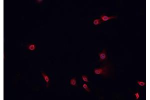 ABIN6268843 staining HeLa cells by IF/ICC.