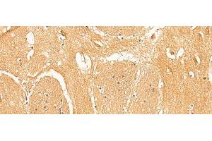 Immunohistochemistry of paraffin-embedded Human brain tissue using PPP1R1A Polyclonal Antibody at dilution of 1:50(x200) (PPP1R1A antibody)