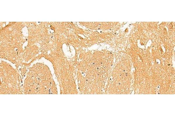 PPP1R1A antibody