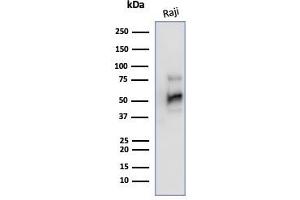 Western Blot Analysis of Raji cell lysate using CD79a Mouse Monoclonal Antibody (JCB117). (CD79a antibody  (AA 202-216))