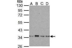 Western Blotting (WB) image for anti-Lactate Dehydrogenase B (LDHB) antibody (ABIN2855152)