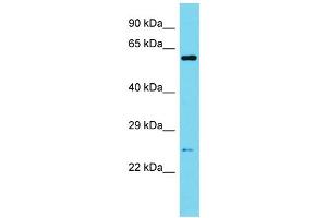 Western Blotting (WB) image for anti-Sperm Associated Antigen 7 (SPAG7) (N-Term) antibody (ABIN2790586) (SPAG7 antibody  (N-Term))