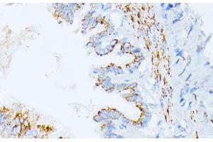 Immunohistochemistry of paraffin-embedded Rat lung using IL3RA Polyclonal Antibody at dilution of 1:100 (40x lens). (IL3RA antibody)