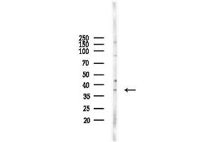 anti-Aldo-keto Reductase Family 1 Member C4 (AKR1C4) antibody