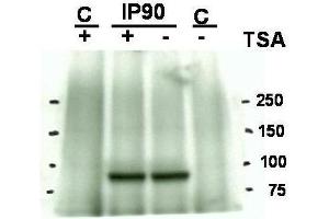 Western blot using  Affinity Purified anti-Hsp90 acetyl K294 antibody shows detection of a band at ~90 kDa corresponding to Hsp90 in an SkBr3 cell lysate (arrowhead) after treatment with Trichostatin A (an HDAC inhibitor). (HSP90 antibody  (Lys294))